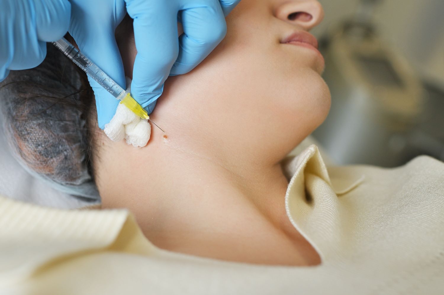 chin liposuction procedure